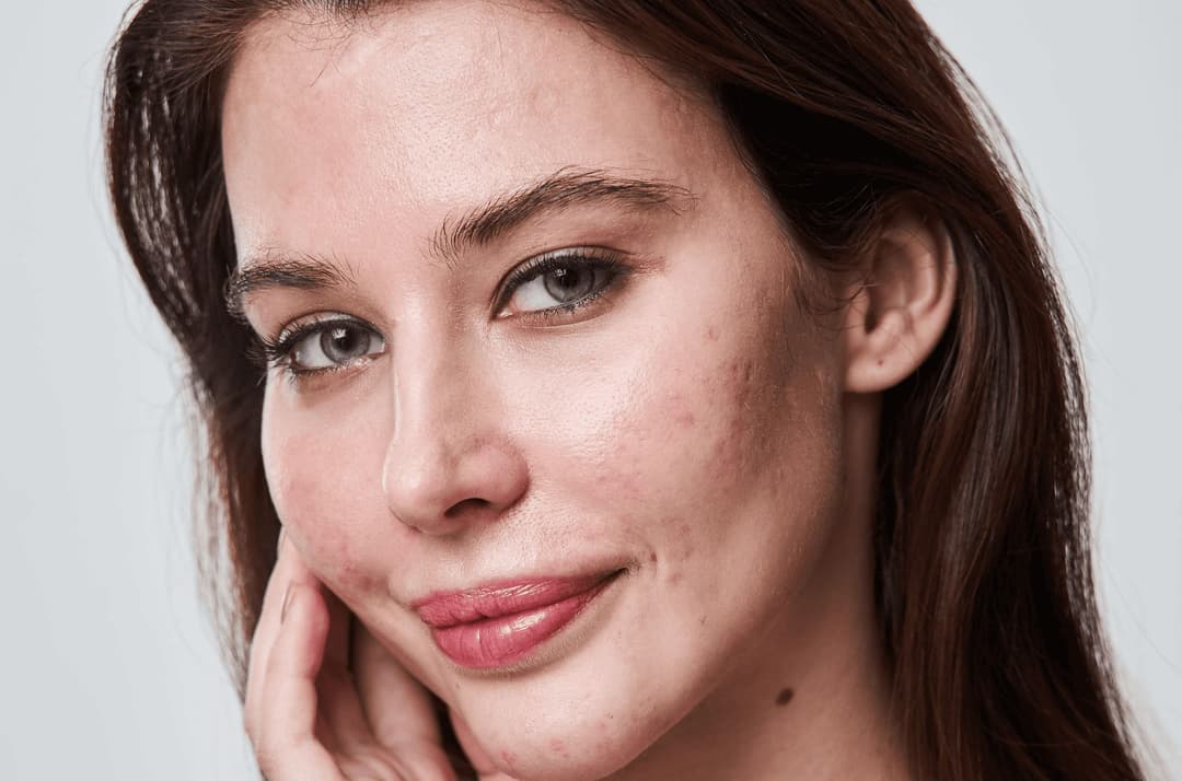 Skin Photo Smooth Skin Photo Editor for Natural Portraits | Aperty
